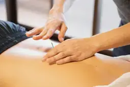 Man receiving dry needling service