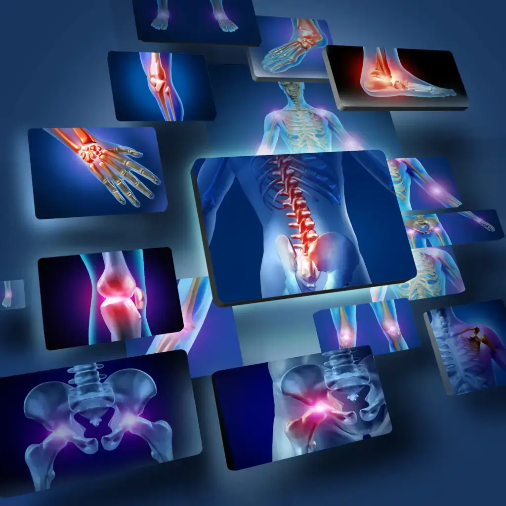 Multiple digital images show highlighted joints and bones, including knees, hips, spine, ankles, hands, and shoulders, indicating areas of pain or inflammation in the human musculoskeletal system.